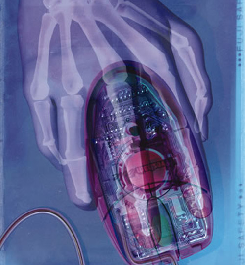 Risultato finale X ray tutorial